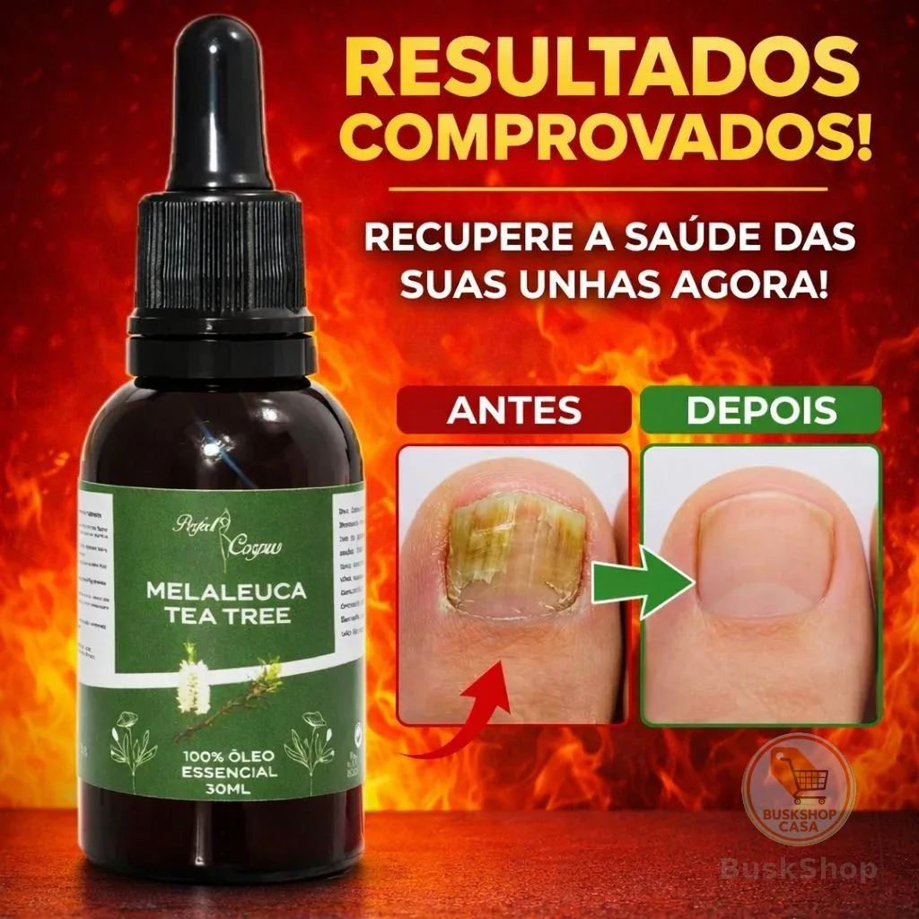 Óleo Essencial de Melaleuca Conta gotas 100% puro 30ML