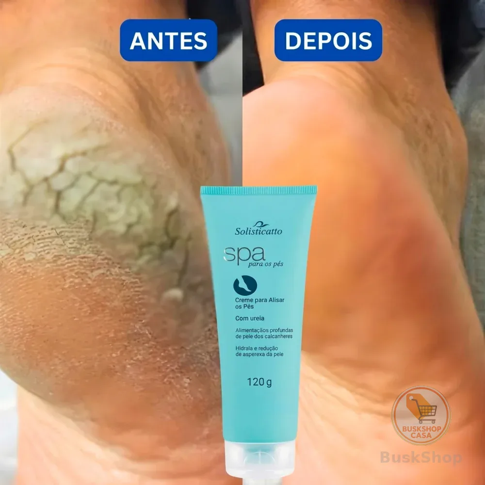 Creme para Pés Rachados Ressecados e Fissurados Spa dos Pés Ureia 10% Hidratação Profunda Calcanhar
