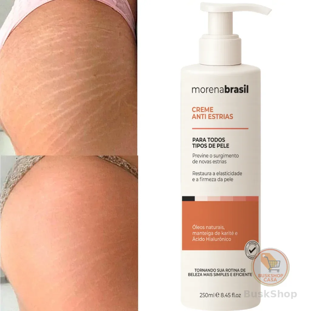 Creme AntiEstrias Removedor Estrias 200g Morena Brasil – Ação Poderosa com Colágeno e Elastina