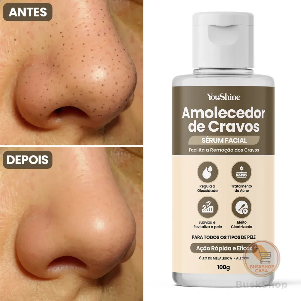 Sérum Amolecedor de Cravos YouShine 100g Facial Auxilia Remoção