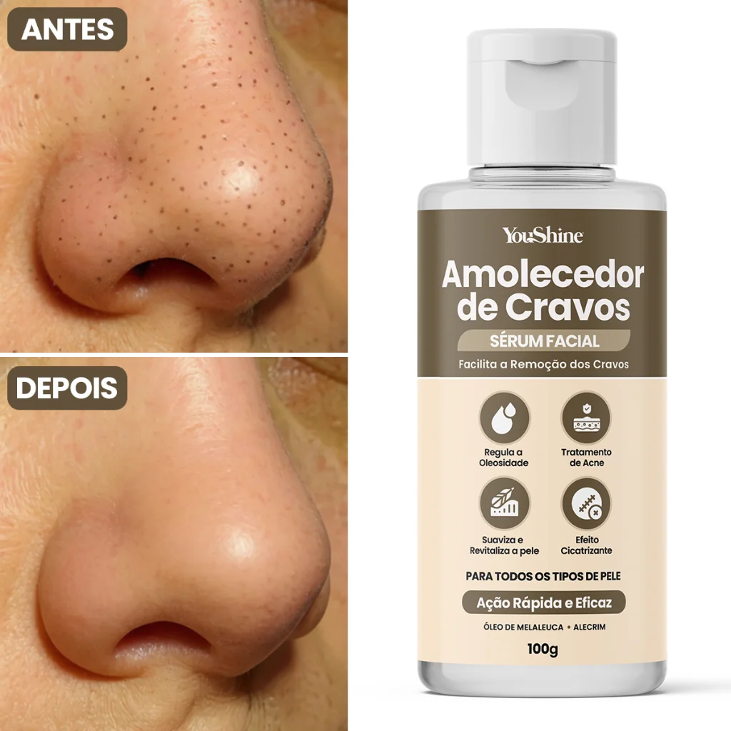 Sérum Amolecedor de Cravos YouShine 100g Facial Auxilia Remoção