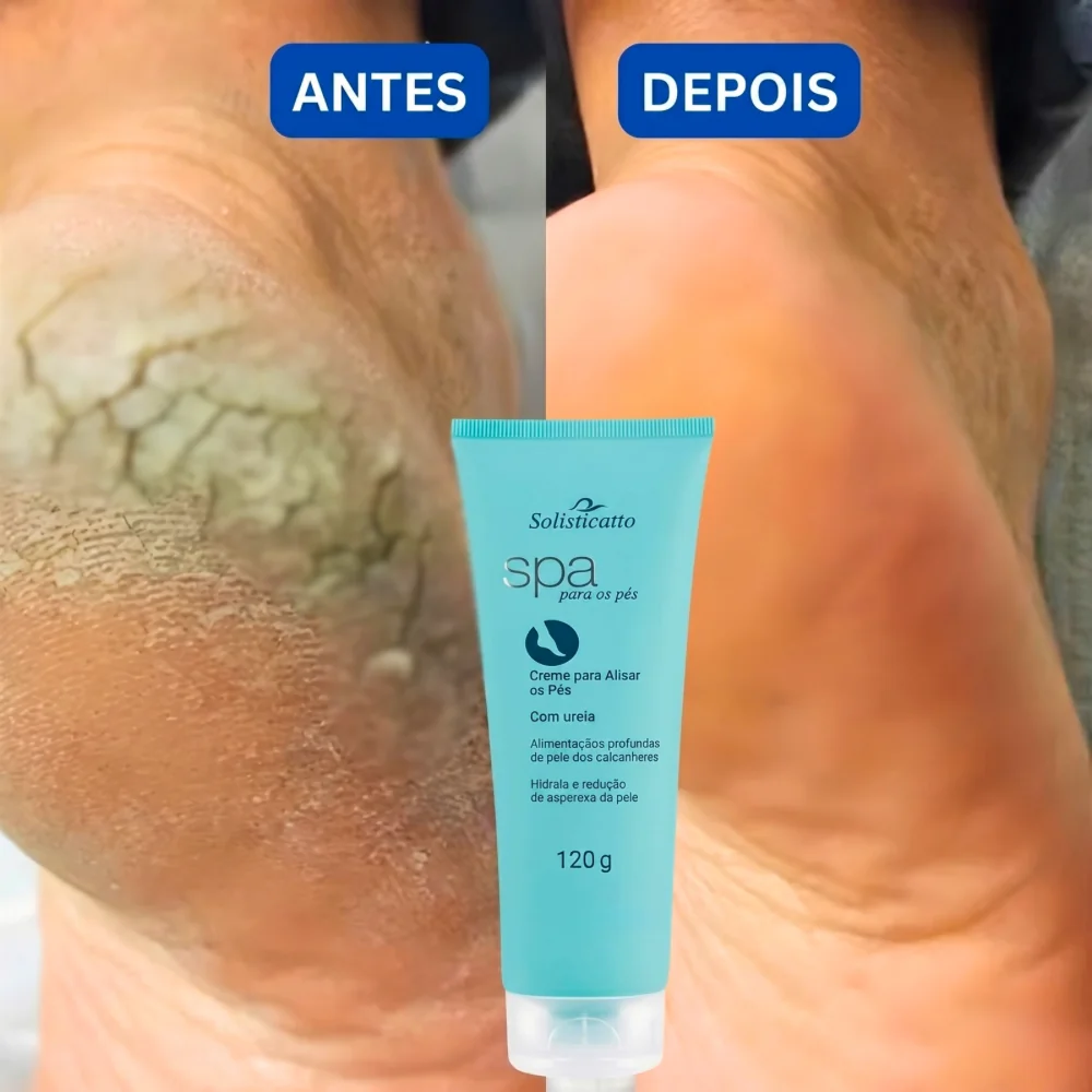 Creme para Pés Rachados Ressecados e Fissurados Spa dos Pés Ureia 10% Hidratação Profunda Calcanhar
